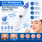 4-in-1 Blackhead & Whitehead Remover product features infographic