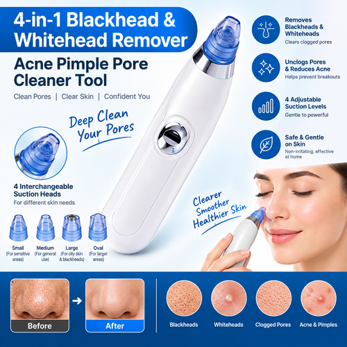 4-in-1 Blackhead & Whitehead Remover product features infographic
